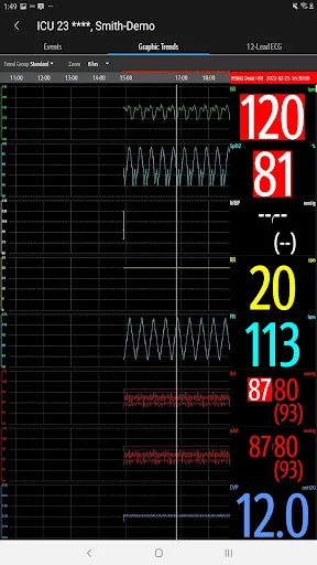 Mindray Mobile Viewer ڈاؤن لوڈ کریں – طبی نگرانی اب آپ کے موبائل پر - Screenshot 23